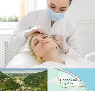 کلینیک زیبایی در چابکسر