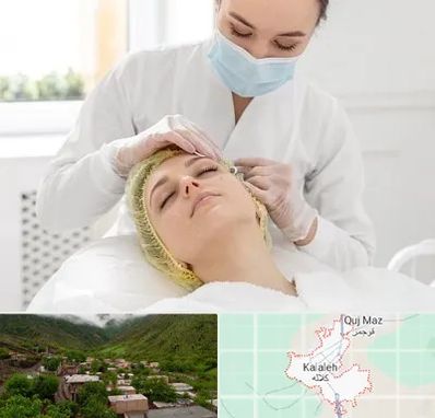 کلینیک زیبایی در کلاله