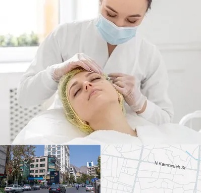 کلینیک زیبایی در کامرانیه