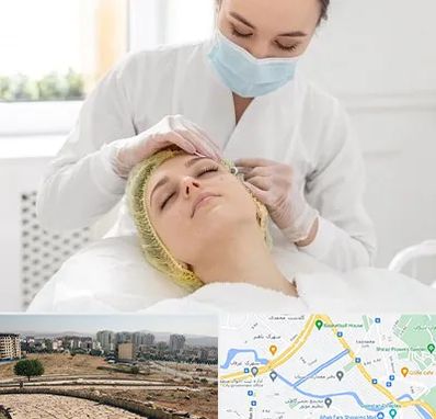 کلینیک زیبایی در کوی وحدت شیراز