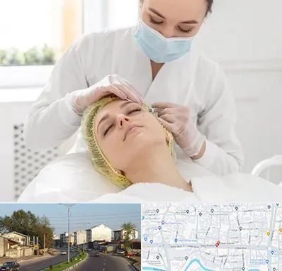 کلینیک زیبایی در ضیابری رشت