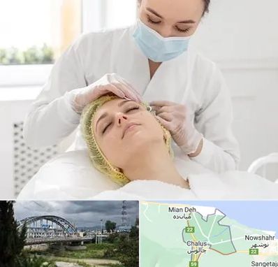 کلینیک زیبایی در چالوس