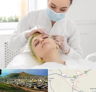 کلینیک زیبایی در بیجار
