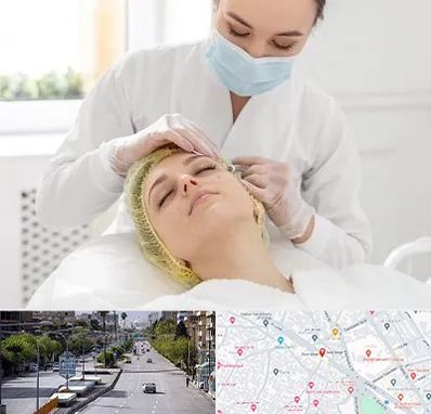 کلینیک زیبایی در خیابان زند شیراز
