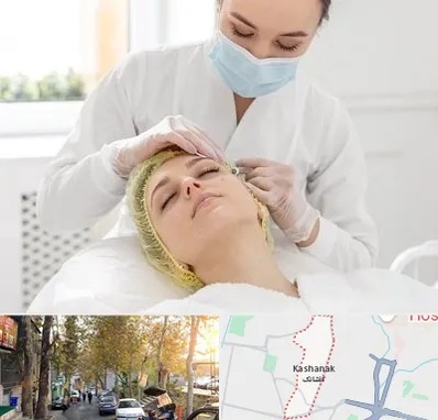 کلینیک زیبایی در کاشانک