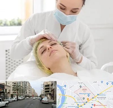 کلینیک زیبایی در زیتون کارمندی اهواز