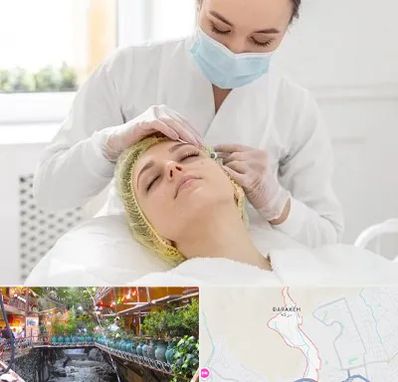 کلینیک زیبایی در درکه