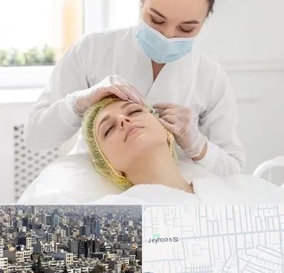 کلینیک زیبایی در جیحون