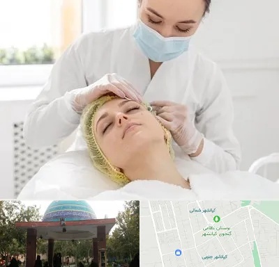 کلینیک زیبایی در کیانشهر