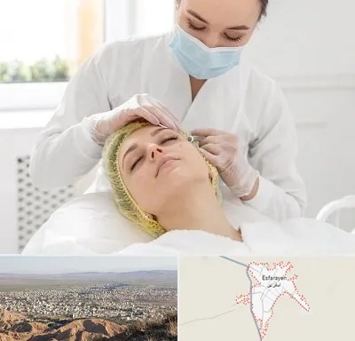 کلینیک زیبایی در اسفراین