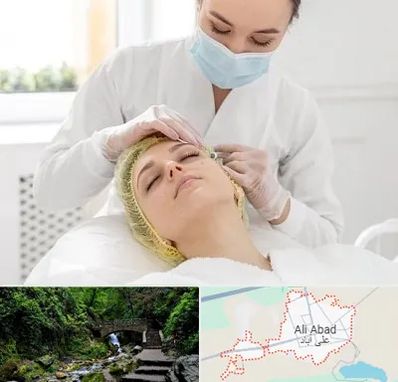 کلینیک زیبایی در علی آباد کتول