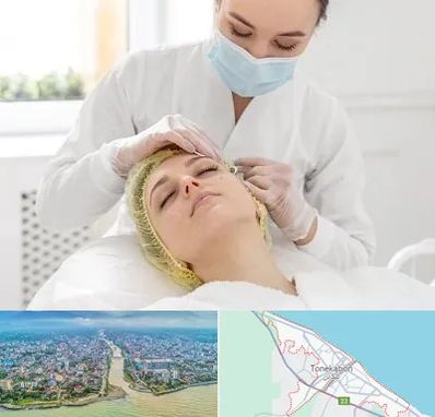 کلینیک زیبایی در تنکابن
