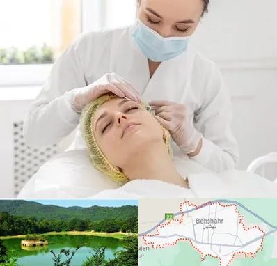 کلینیک زیبایی در بهشهر