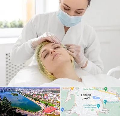 کلینیک زیبایی در لاهیجان