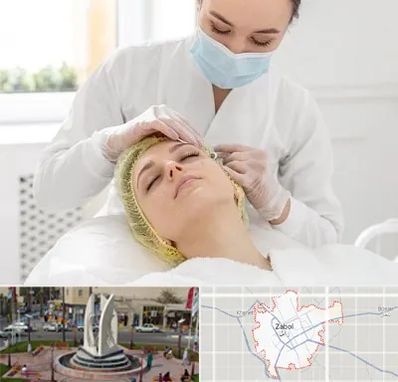 کلینیک زیبایی در زابل