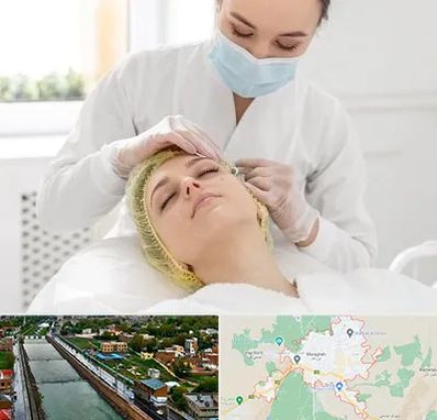 کلینیک زیبایی در مراغه