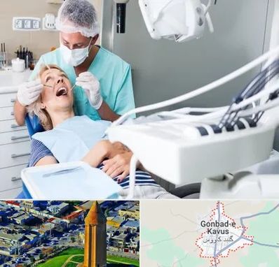 جراح دندانپزشک در گنبد کاووس