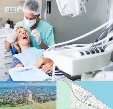 جراح دندانپزشک در تنکابن