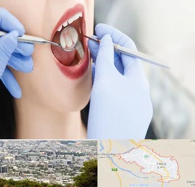 جراح دندان عقل در یاسوج