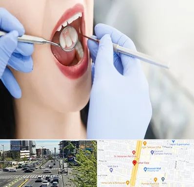 جراح دندان عقل در ستاری