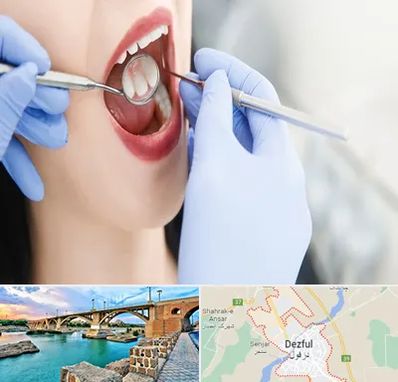 جراح دندان عقل در دزفول