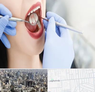جراح دندان عقل در جیحون