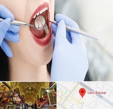 جراح دندان عقل در بازار وکیل شیراز