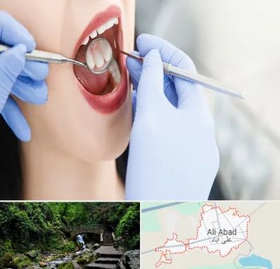 جراح دندان عقل در علی آباد کتول