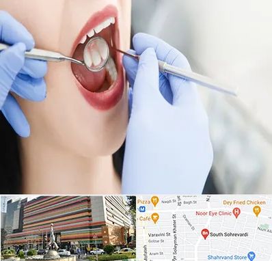 جراح دندان عقل در سهروردی 