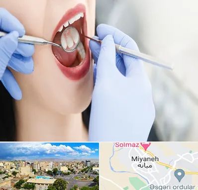 جراح دندان عقل در میانه