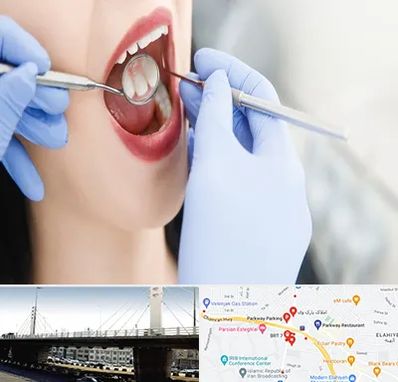 جراح دندان عقل در پارک وی 