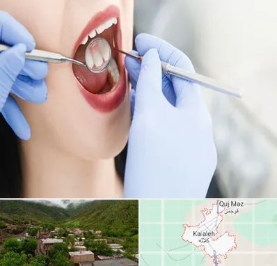 جراح دندان عقل در کلاله