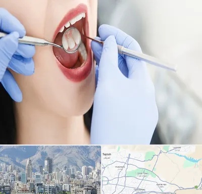 جراح دندان عقل در شمال شرق تهران