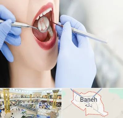 جراح دندان عقل در بانه