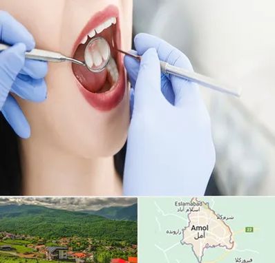 جراح دندان عقل در آمل