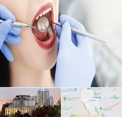 جراح دندان عقل در فرشته 