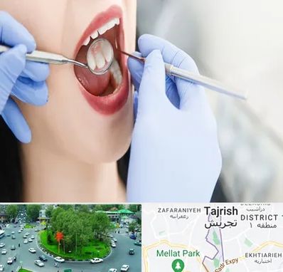 جراح دندان عقل در تجریش 