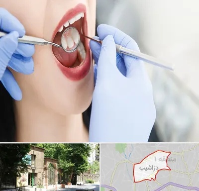 جراح دندان عقل در دزاشیب