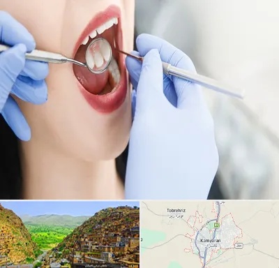 جراح دندان عقل در کامیاران