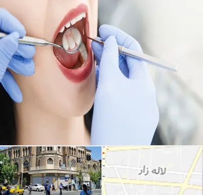 جراح دندان عقل در لاله زار