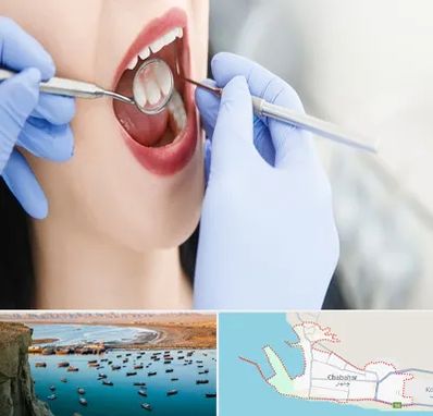 جراح دندان عقل در چابهار