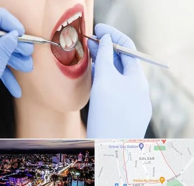 جراح دندان عقل در گلسار رشت 