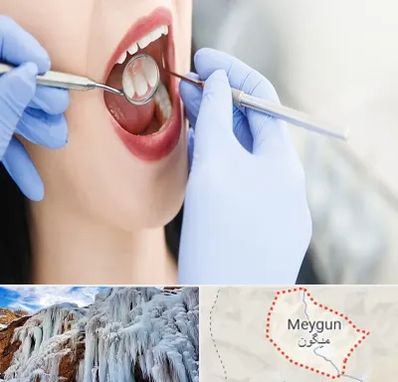 جراح دندان عقل در میگون