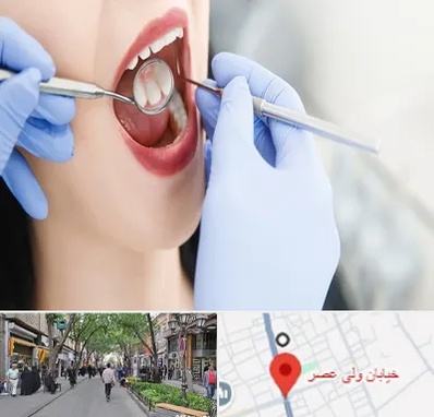 جراح دندان عقل در ولیعصر شهریار