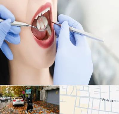 جراح دندان عقل در خیابان فلسطین