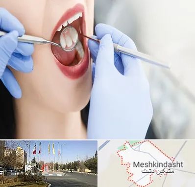 جراح دندان عقل در مشکین دشت