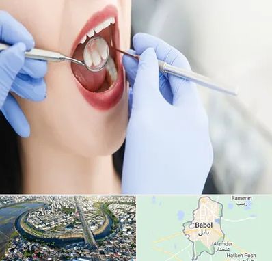 جراح دندان عقل در بابل