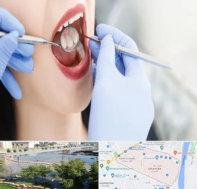 جراح دندان عقل در گلستان اهواز