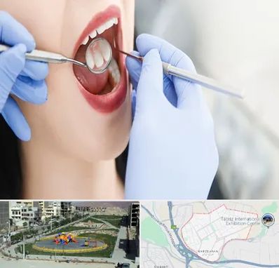 جراح دندان عقل در مرزداران تبریز