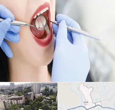 جراح دندان عقل در اوین